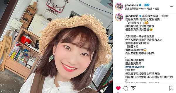 艾麗斯新聚雙旋乳酸術後一個月效果自然