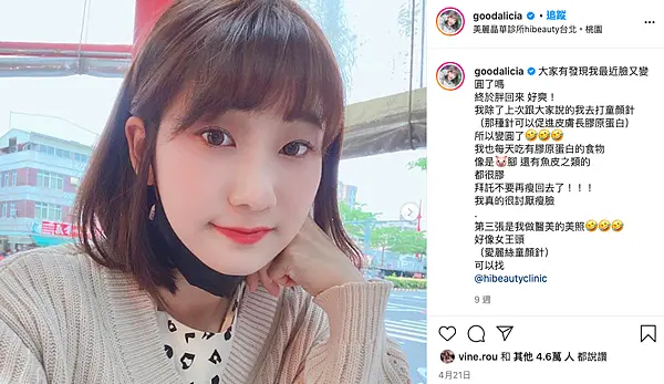 艾麗斯新聚雙旋乳酸術後膠原蛋白增生臉頰自然澎潤
