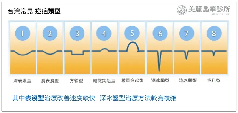 台灣常見痘疤類型