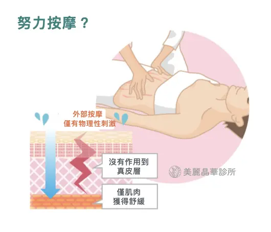 破除 妊娠紋 迷思，去美容院努力按摩