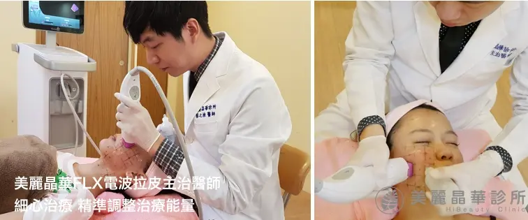 淚溝使用電波拉皮改善
