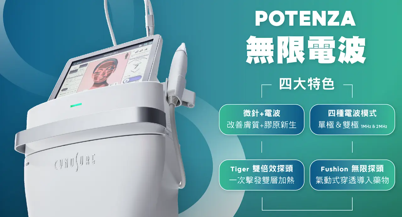 無限電波四大特色