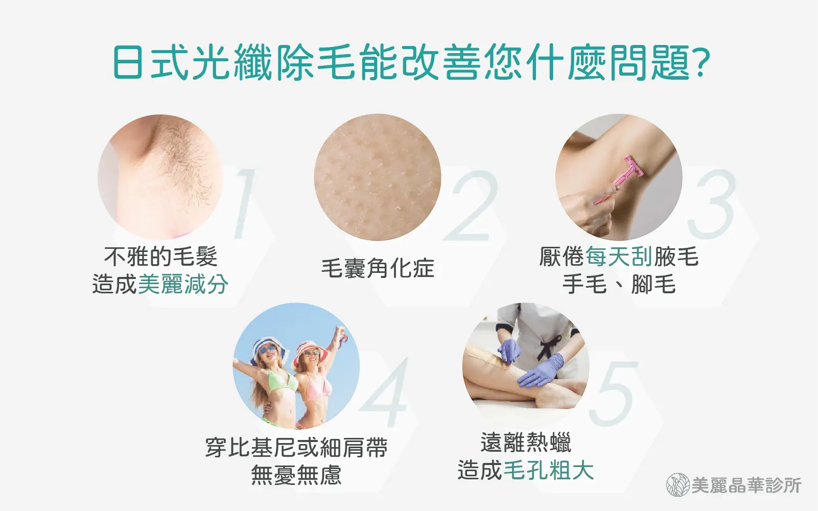 雷射除毛