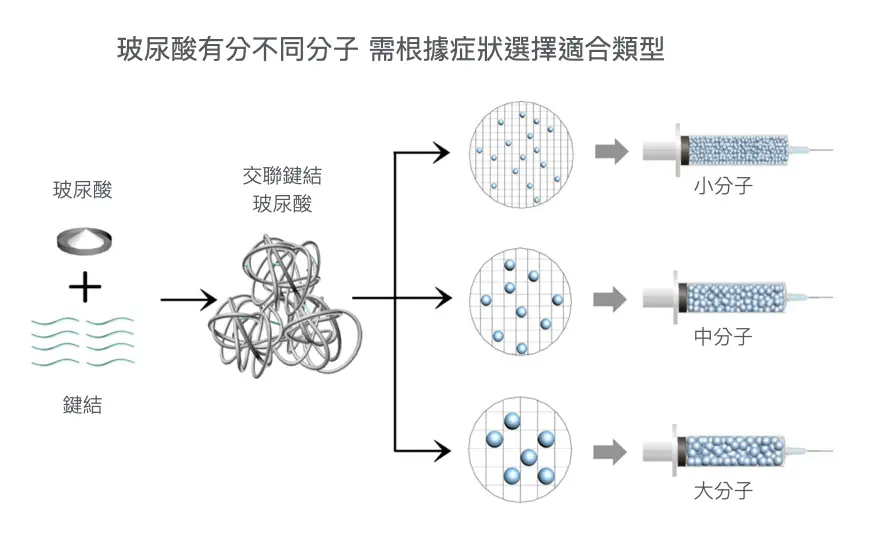 淚溝 使用玻尿酸