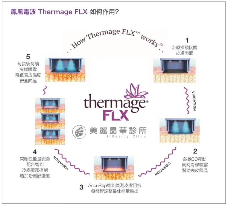 電波拉皮的原理