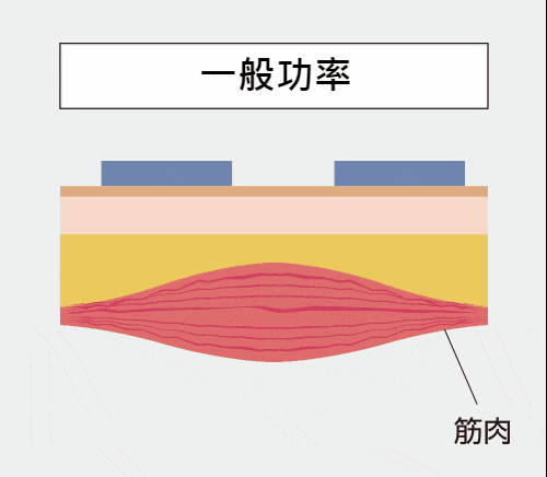 肌動減脂emsculpt增肌減脂低特斯拉功率高，效果慢