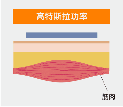 肌動減脂CMslim高特斯拉功率高，效果快