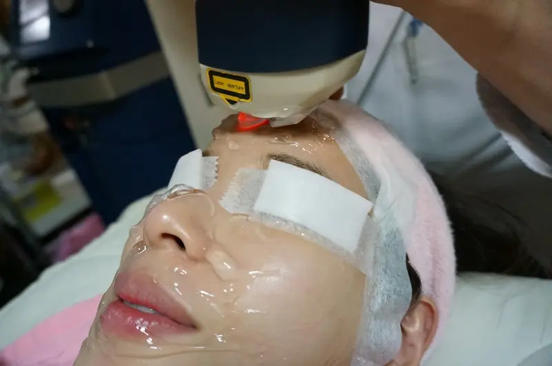 粉餅雷射無傷口無修復期