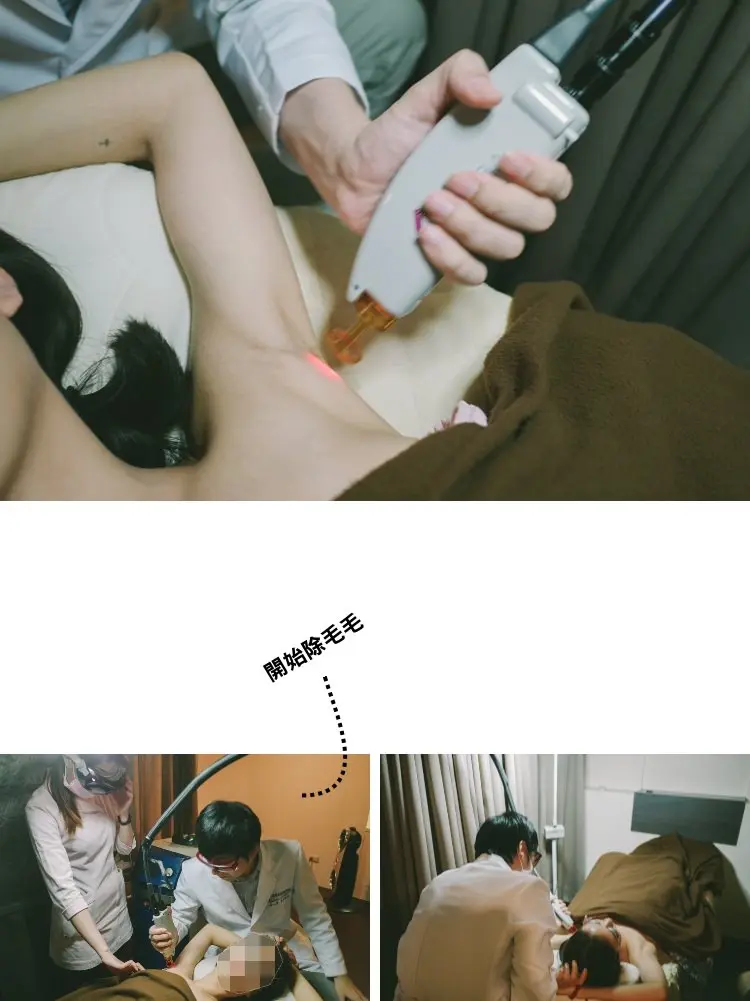 蔡之棟醫師雷射除毛治療過程