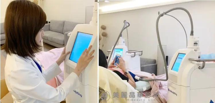雙機體外減脂-酷塑冷凍減脂儀器
