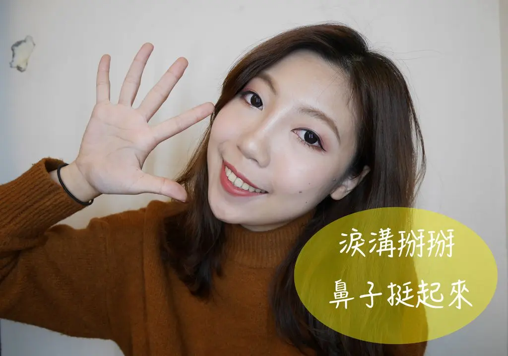 玻尿酸隆鼻玻尿酸淚溝治療分享
