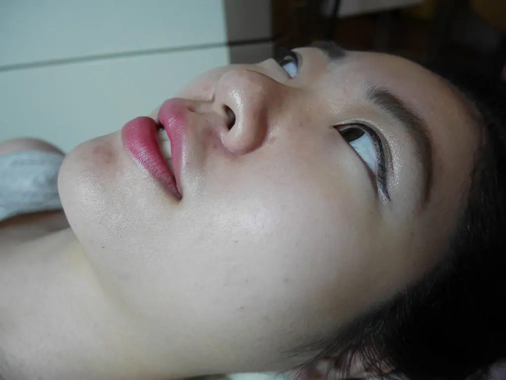 水涵氧術前
