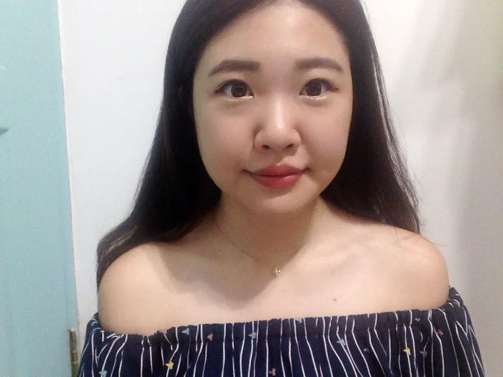 肉毒瘦小臉術後