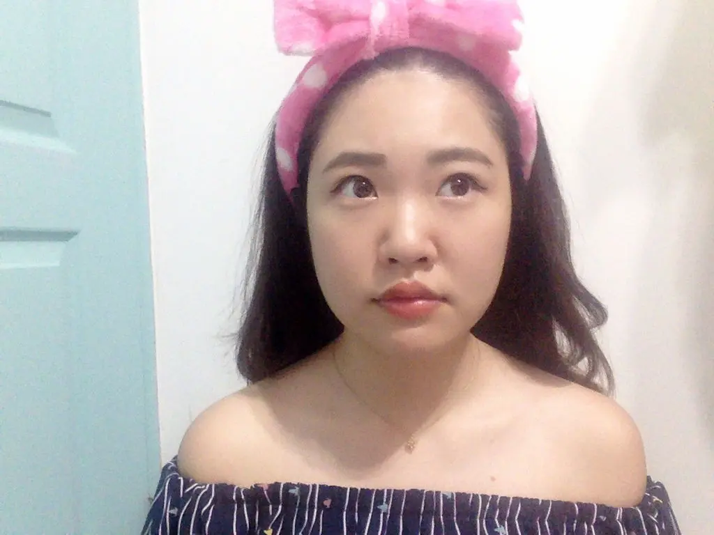 肉毒瘦小臉術後