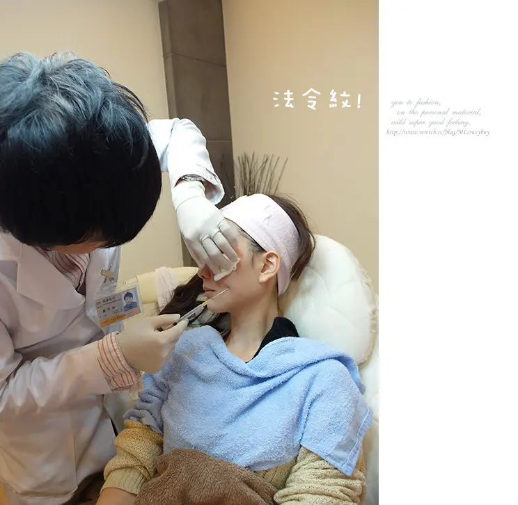 翁子軒醫師專業3D聚左旋乳酸治療法令紋
