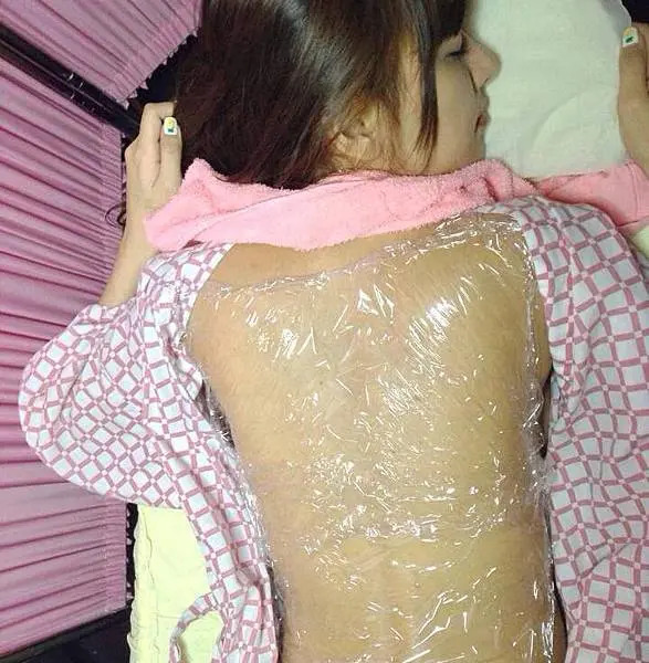 杏仁酸美背