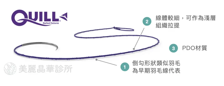 埋線拉提線材 2 : Quill (俗稱羽毛線）