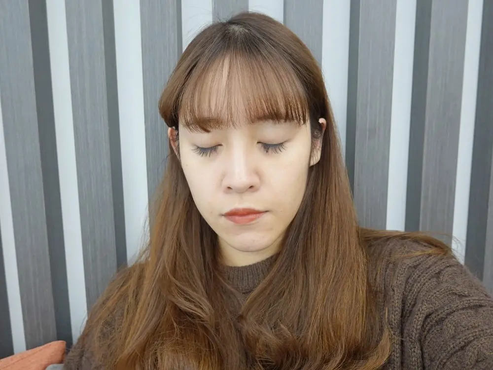 玻尿酸下巴改善不對稱修飾臉型