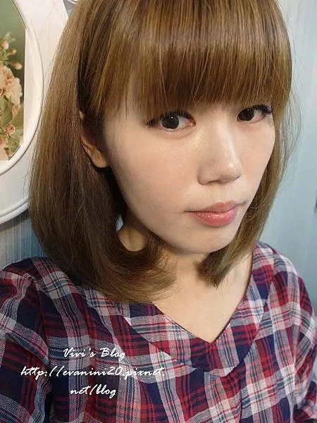 3D聚左旋乳酸治療後臥蠶變明顯