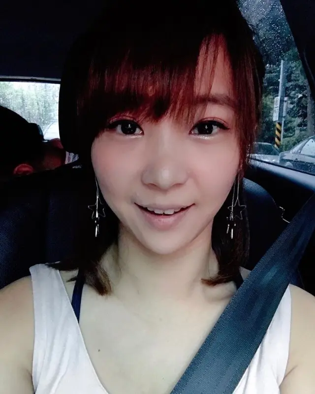 ulthera極線音波拉皮術後臉明顯變V