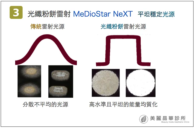 德國光纖粉餅雷射平坦穩定雷射光源