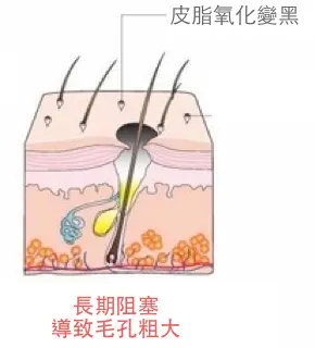 201606131347321