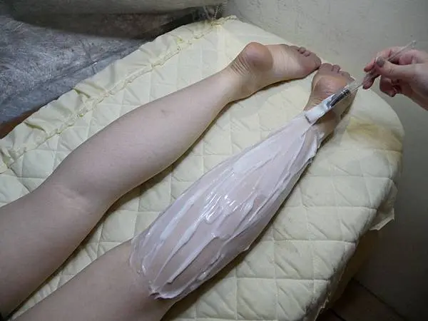肉毒瘦小腿術前敷麻藥