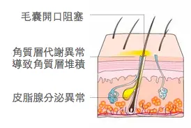 201611042209561