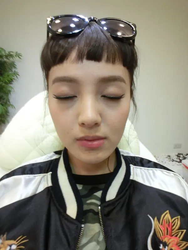 玻尿酸下巴治療前左右明顯不對稱
