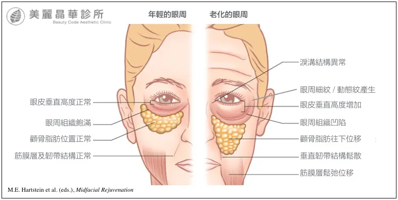 年輕與老化眼周的差異