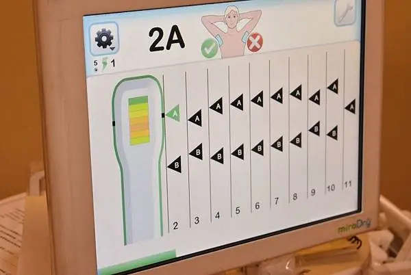 Miradry腋淨爽改善多汗症