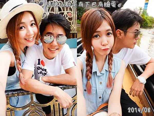 肉毒瘦臉術後拍照輪廓明顯