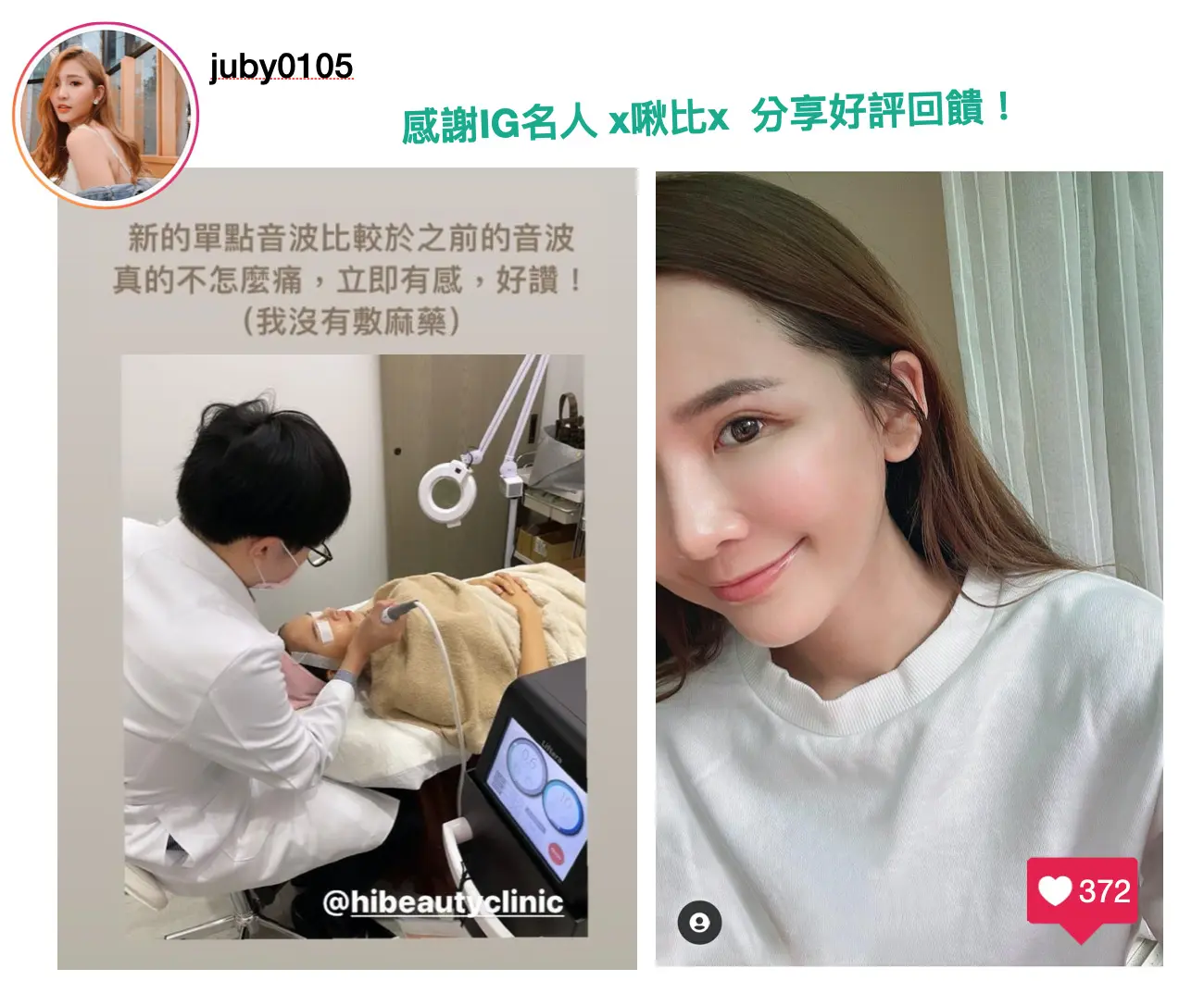 感謝IG名人啾比分享渦旋音波好評回饋
