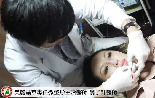 美麗晶華專任微整形主治醫師翁子軒醫師