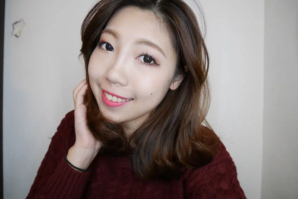 玻尿酸淚溝術後