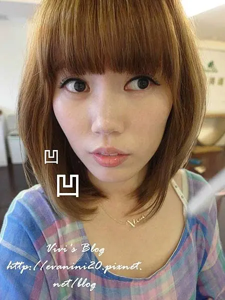 3D聚左旋乳酸治療前臉頰凹陷