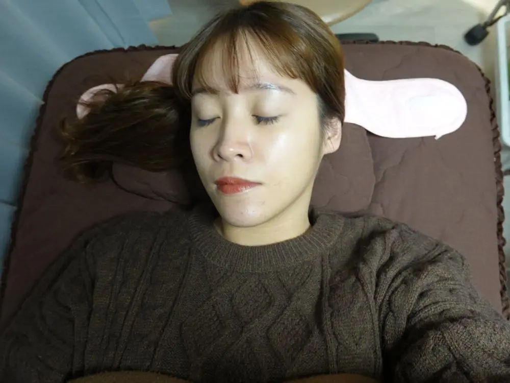 玻尿酸下巴術前