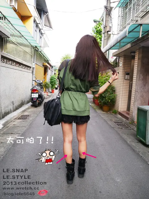 肉毒瘦小腿術前小腿粗壯