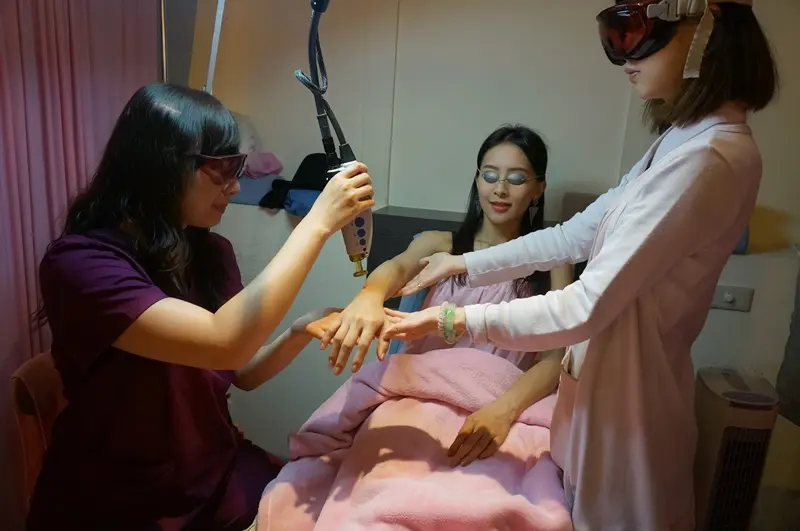 雷射除手毛女醫師親切治療