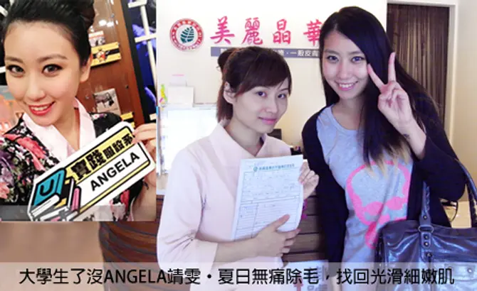 大學生了沒Angela靖雯推薦雷射除毛