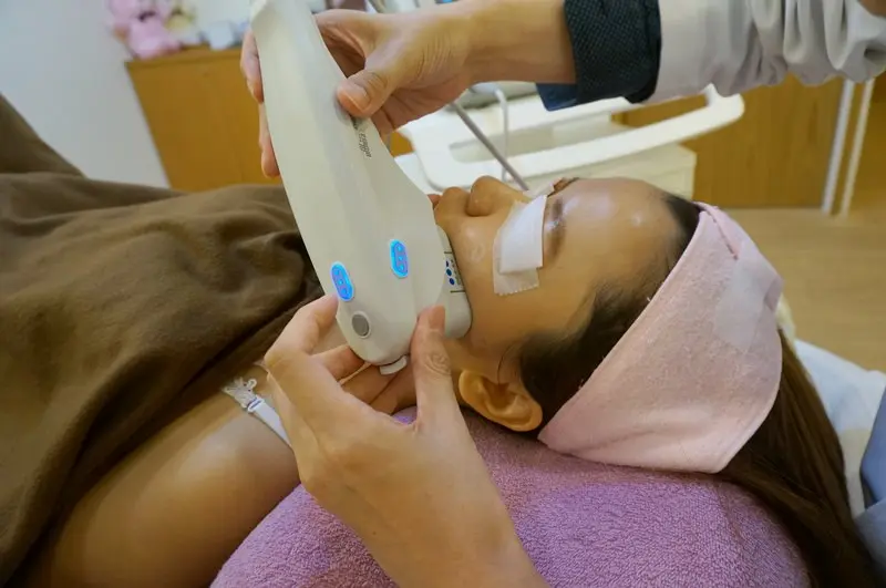 極線音波拉提臉頰部位