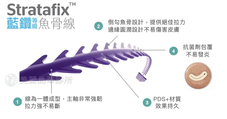 埋線拉提線材 1 : Stratafix (俗稱藍鑽等級魚骨線)