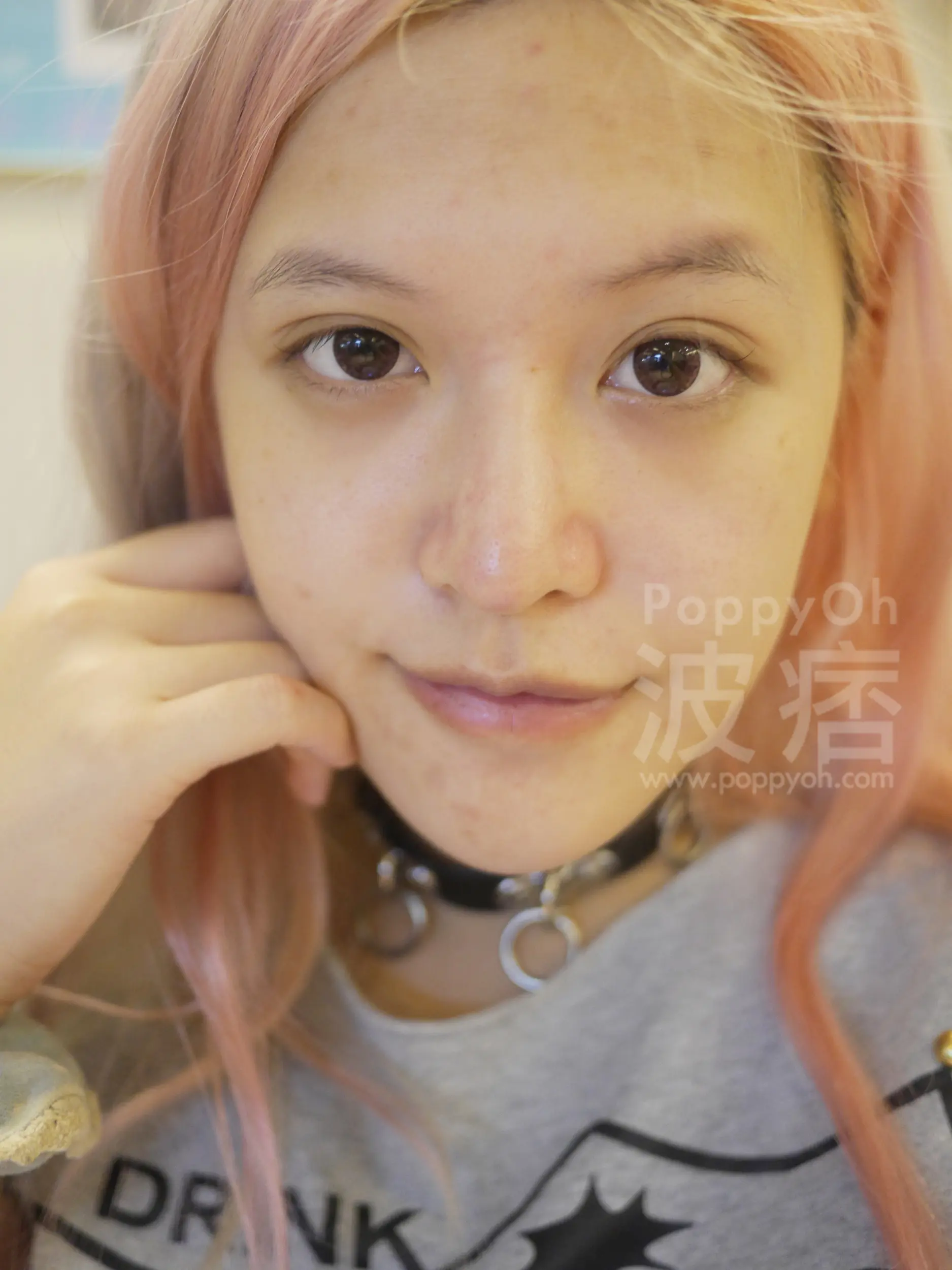 光纖粉餅雷射無傷口術後可立即上妝