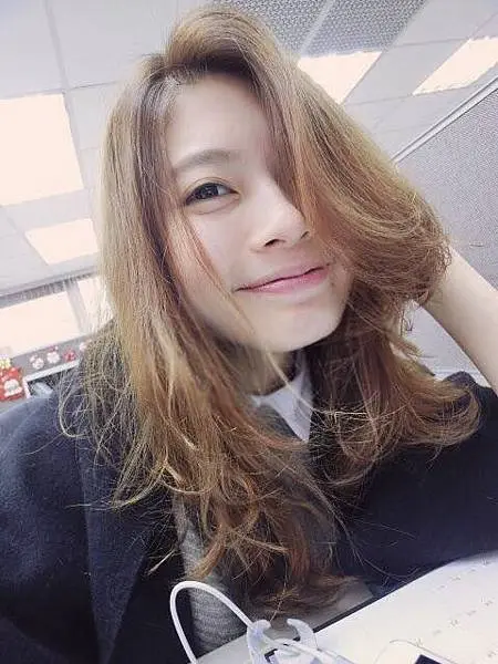 肉毒抬頭紋術後