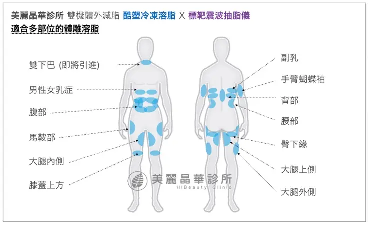 雙機體外溶脂適合多部位溶脂