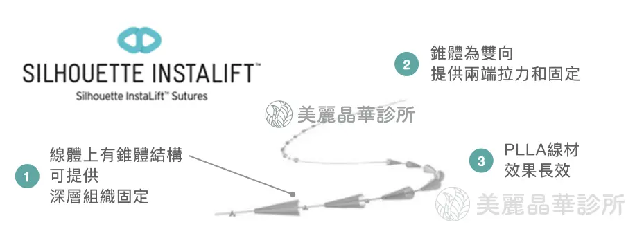 埋線拉提線材 4 : Silhouette instalift (俗稱塑立愛立提線)