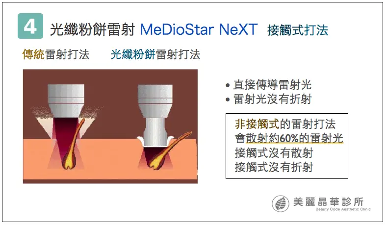 德國光纖粉餅雷射接觸式打法