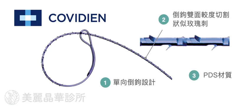 埋線拉提線材 5 : V-Loc (俗稱倒鉤線/維納斯線)
