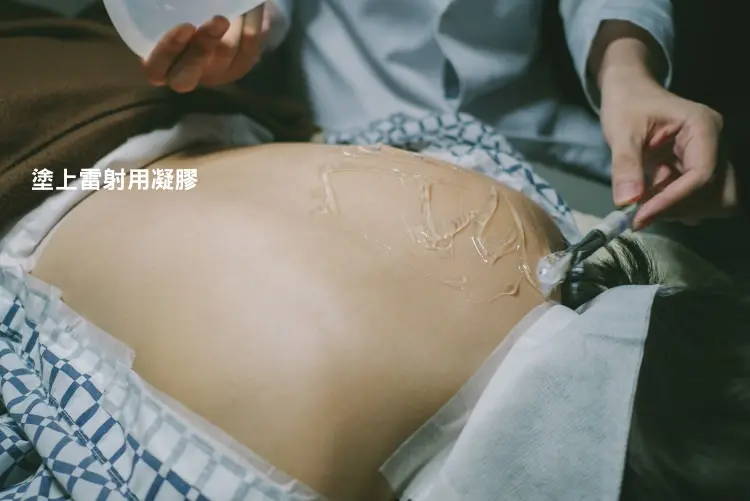 粉餅雷射美背術前塗上專用凝膠