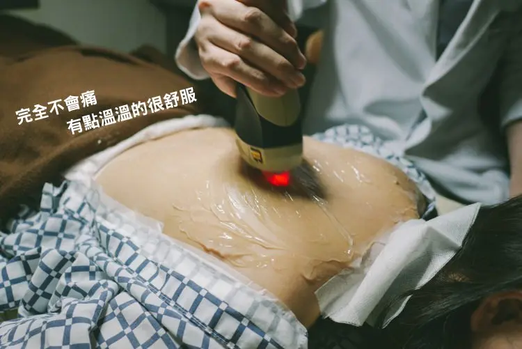 粉餅雷射治療背部過程